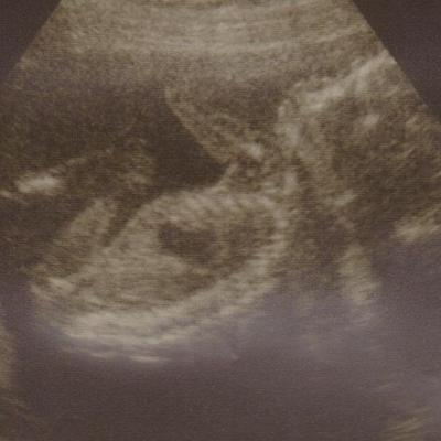 Wann wird unsere kleine Lien Jil geboren? Offizieller Geburtstermin ist der 12.12.2011. :-)